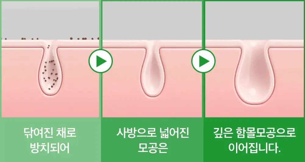 [모공탄력케어] 성분에디터 그린토마토 NMN 포어 필링 패드 60매 상세페이지 15
